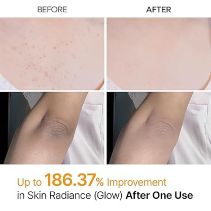 Yuna Skin Koljic Acid Peel Shot